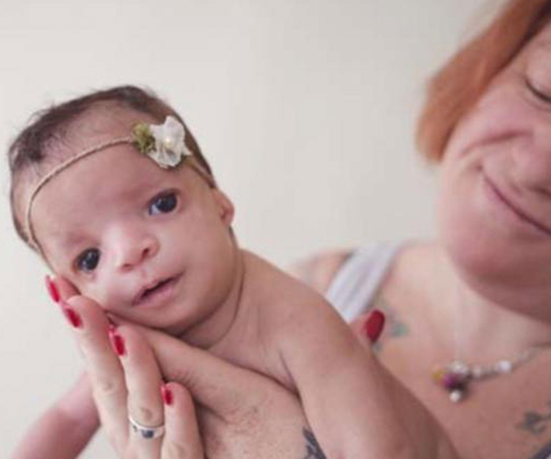 Adoptive mum abandons baby with birth defect
