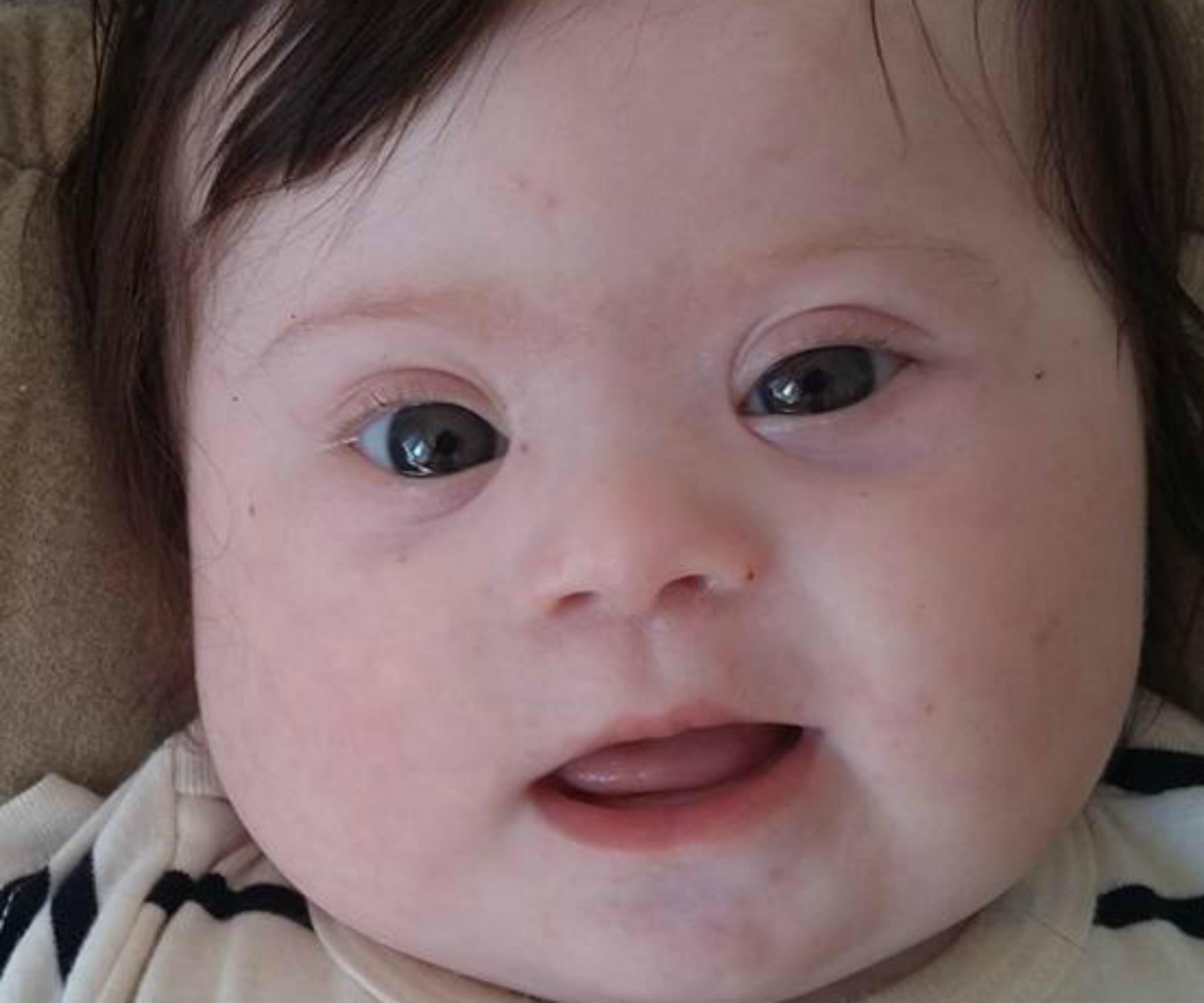 Meet Louise, my 4-month-old with two arms, two legs and one extra chromosome