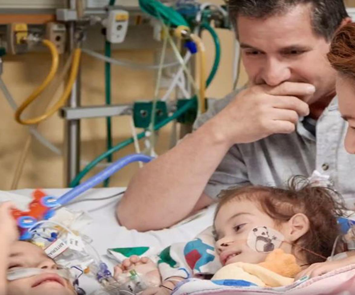 Conjoined twins reunited for the first time post-surgery