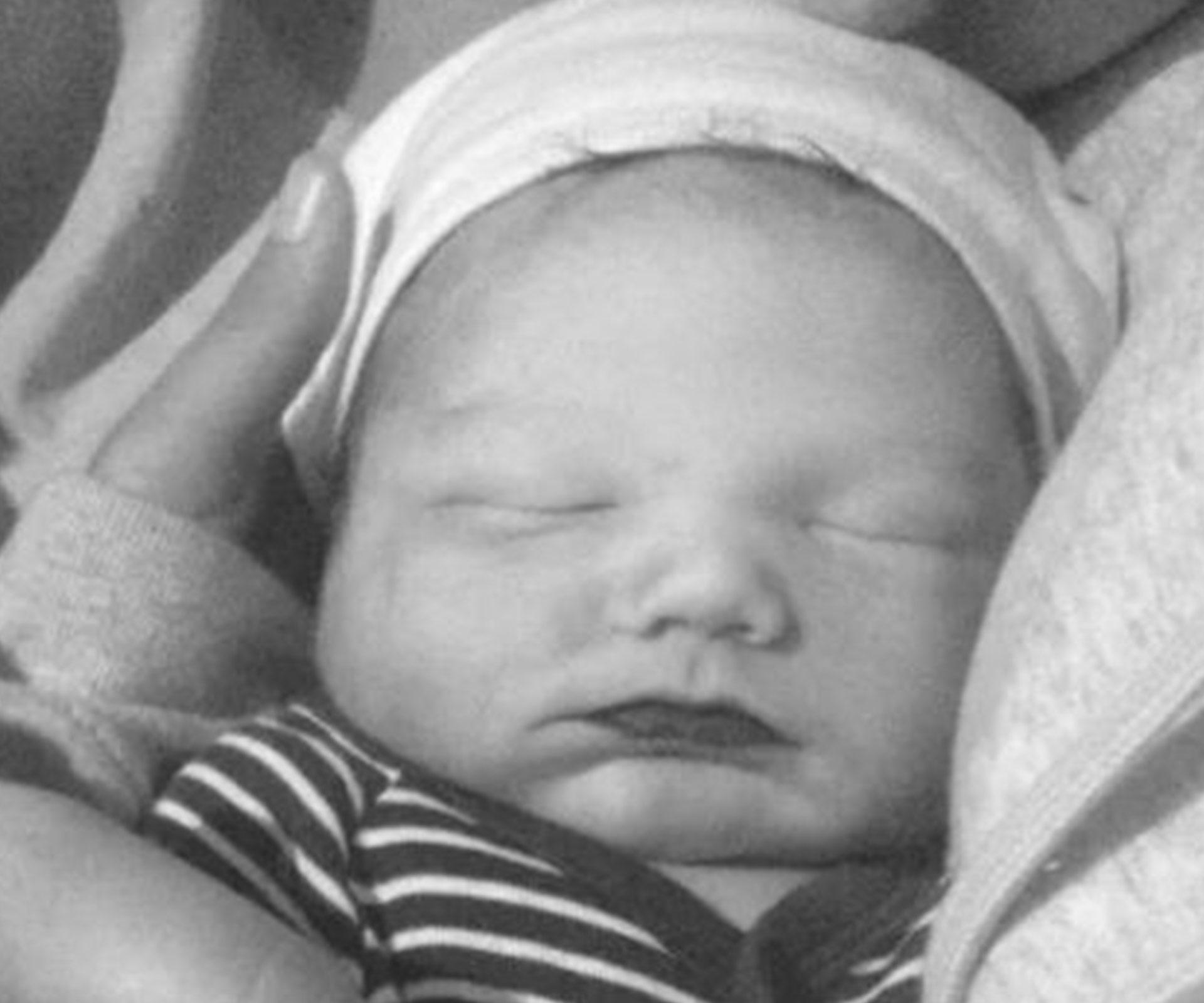 Baby dies after his skull was fractured during C-section