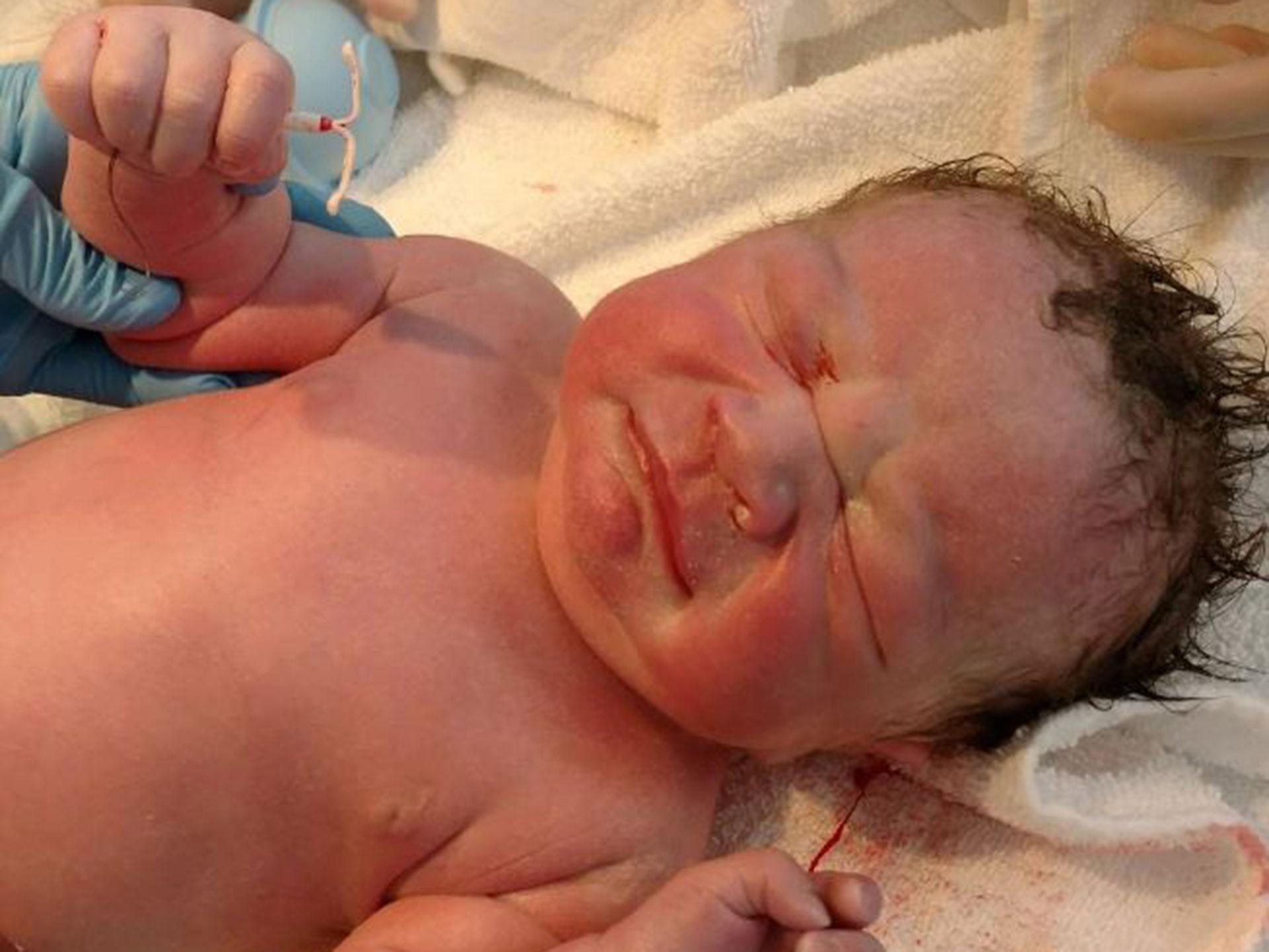 Why this baby was photographed holding his mum’s ‘failed’ IUD