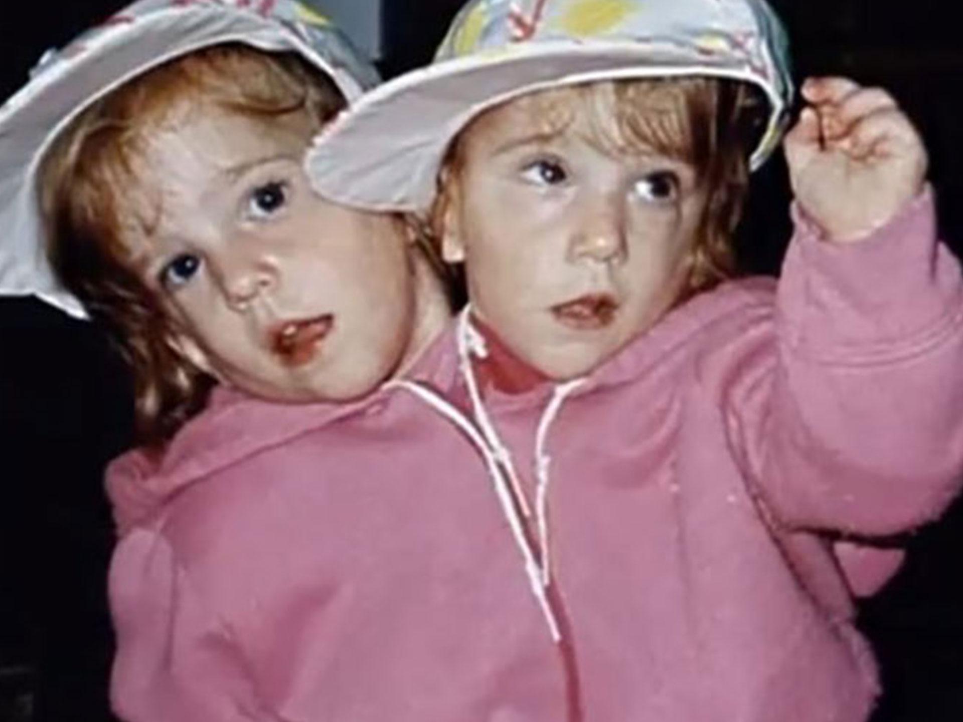 Conjoined twins Abby and Brittany Hensel: where are they now?