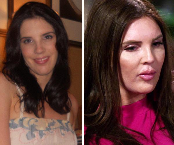 Tracey Jewel Married At First Sight plastic surgery