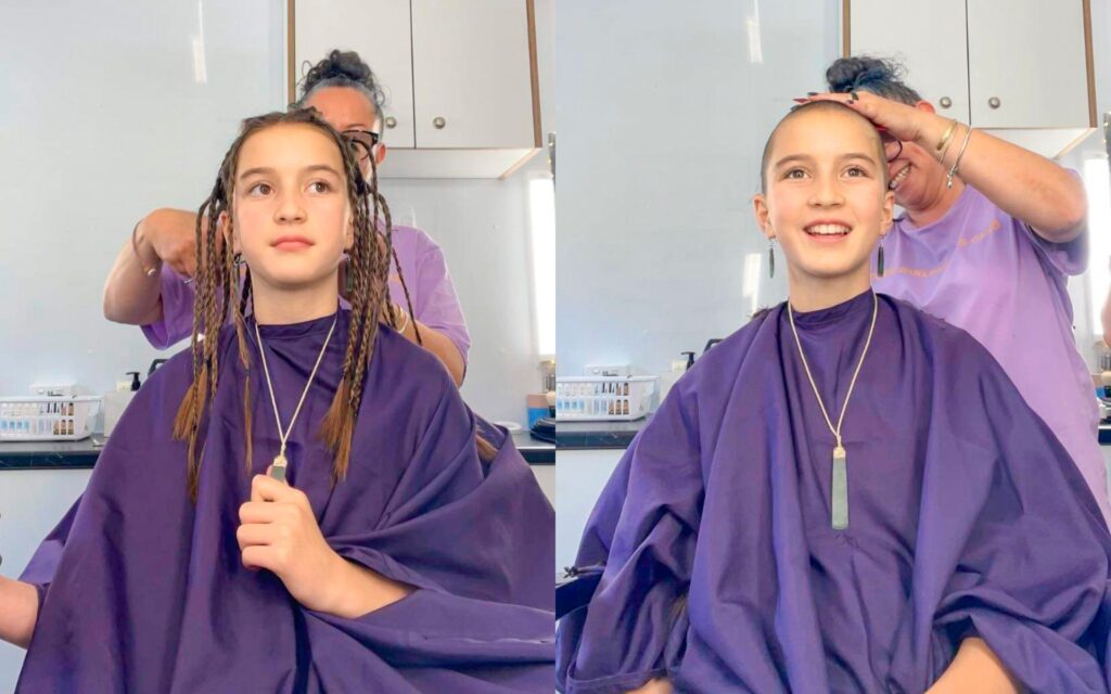 Actress Elizabeth Atkinson before and after the big shave