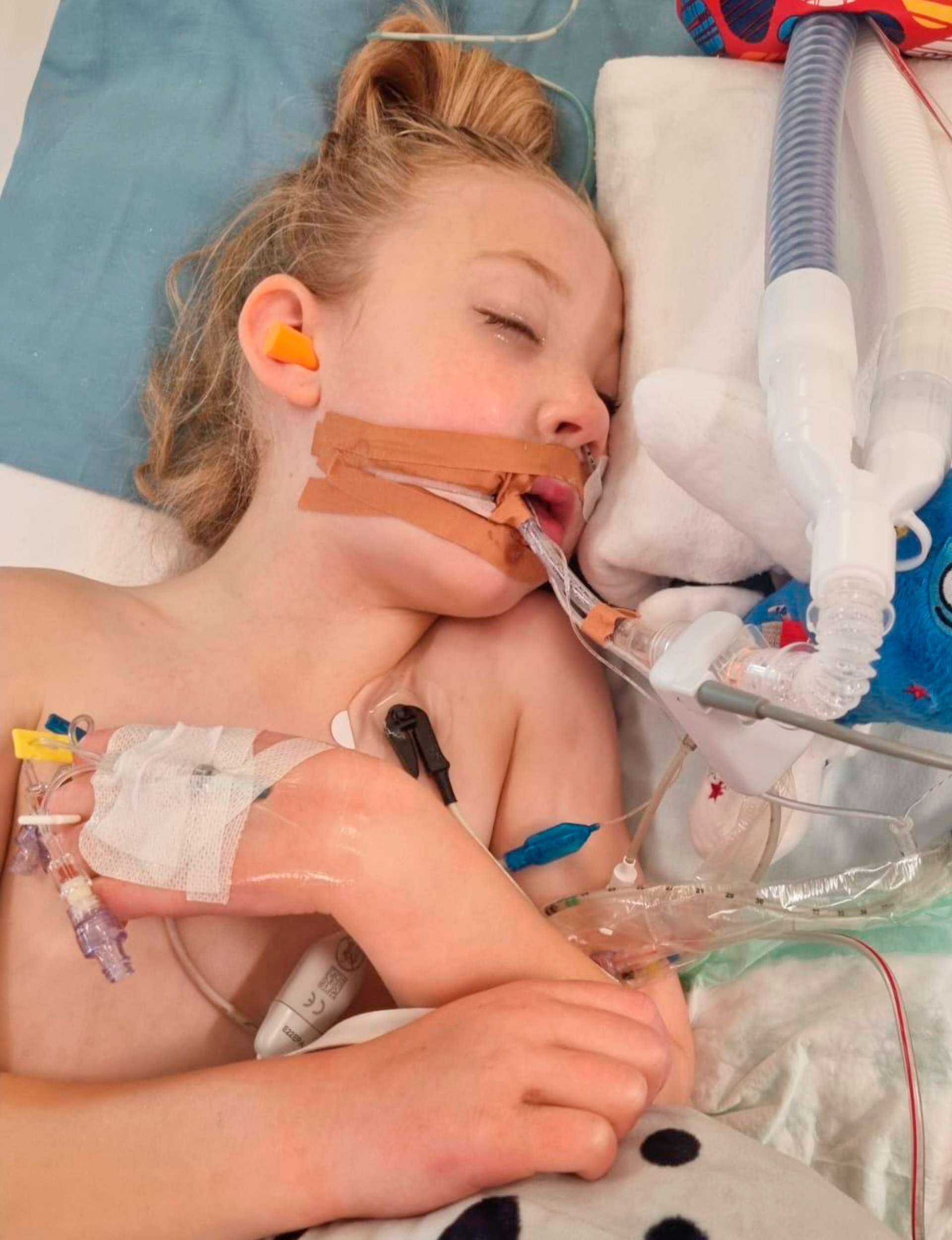 Isla van der Westhuizen in an induced coma