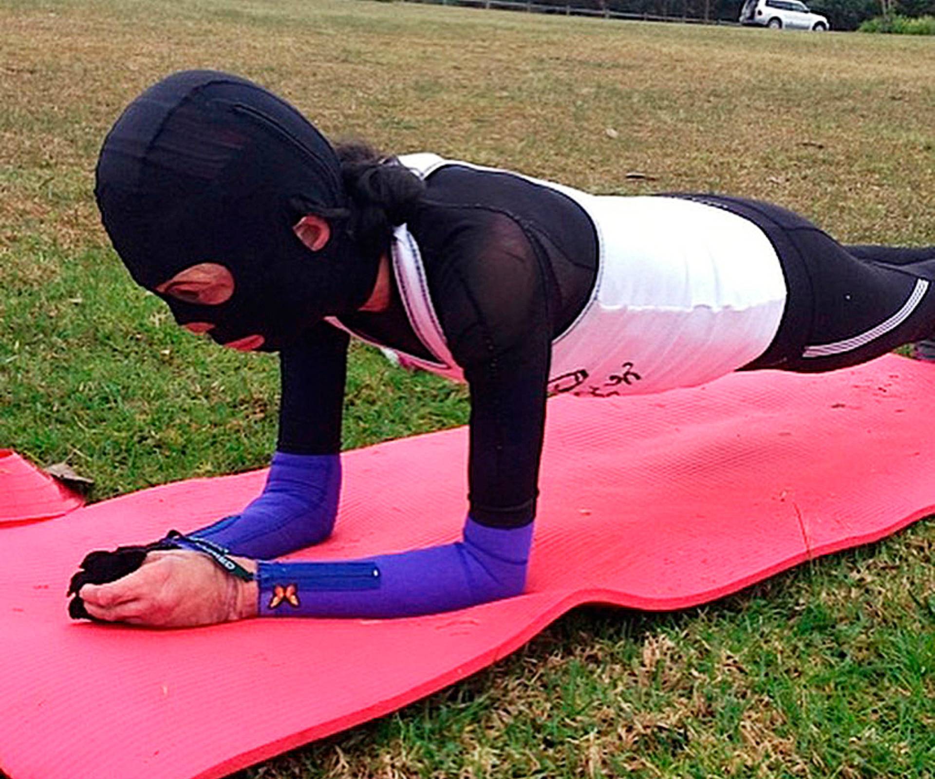 Turia Pitt doing a plank in a park with her compression mask and bandages on
