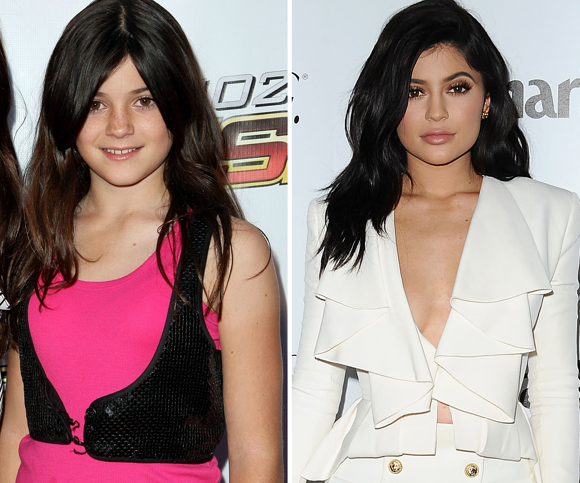 Keeping up with Kylie Jenner’s ever-changing face
