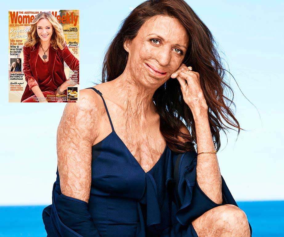 Touching new details behind Turia Pitt’s miracle pregnancy