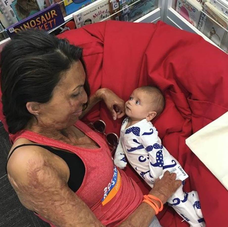 Turia Pitt shares more adorable motherhood pictures