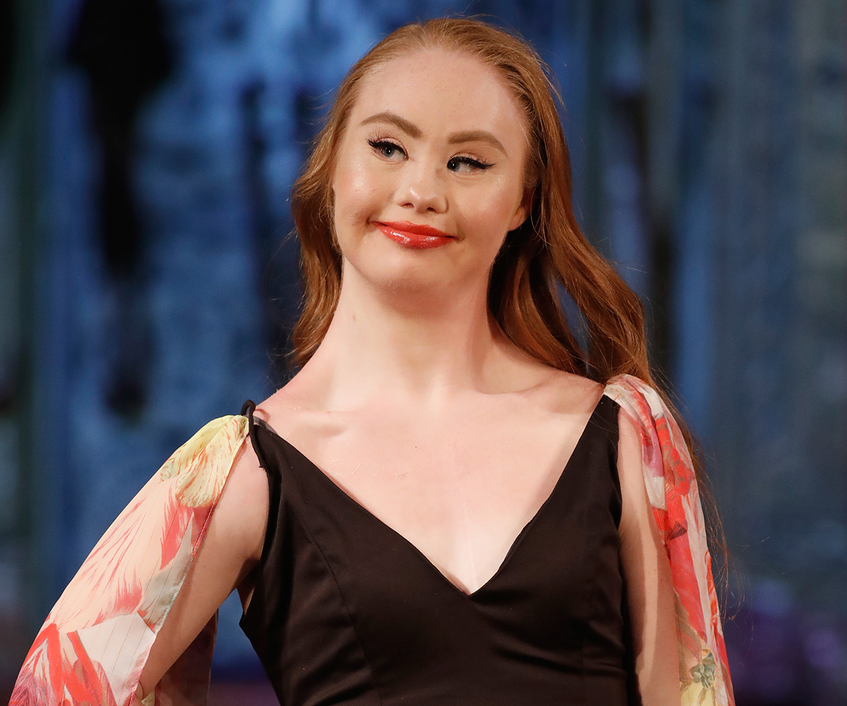 Madeline Stuart the Down syndrome model has had surgery for heart failure