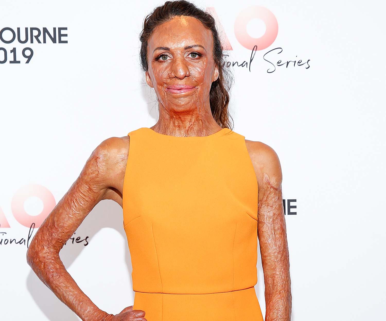 ‘It’s exhausting’: Turia Pitt shares emotional message about the reality of caring for a newborn