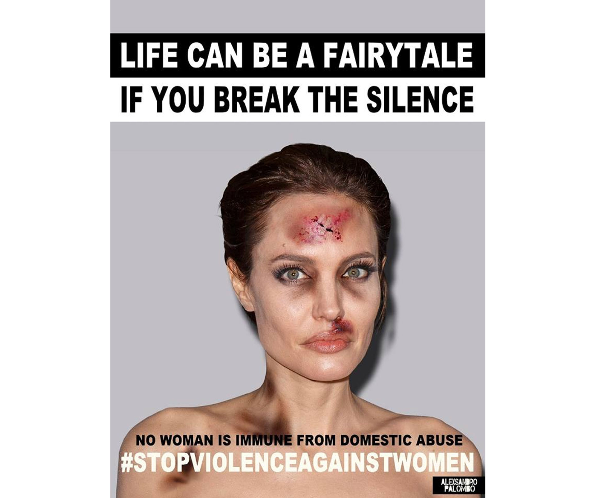 Celebrities given bruises for shocking domestic violence campaign