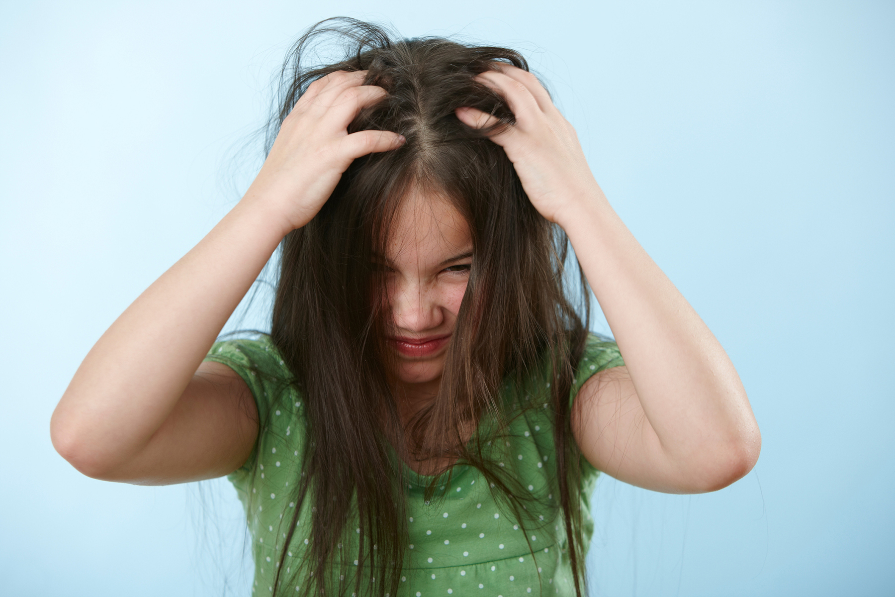 ‘Super’ head lice now resistant to over-the-counter treatments