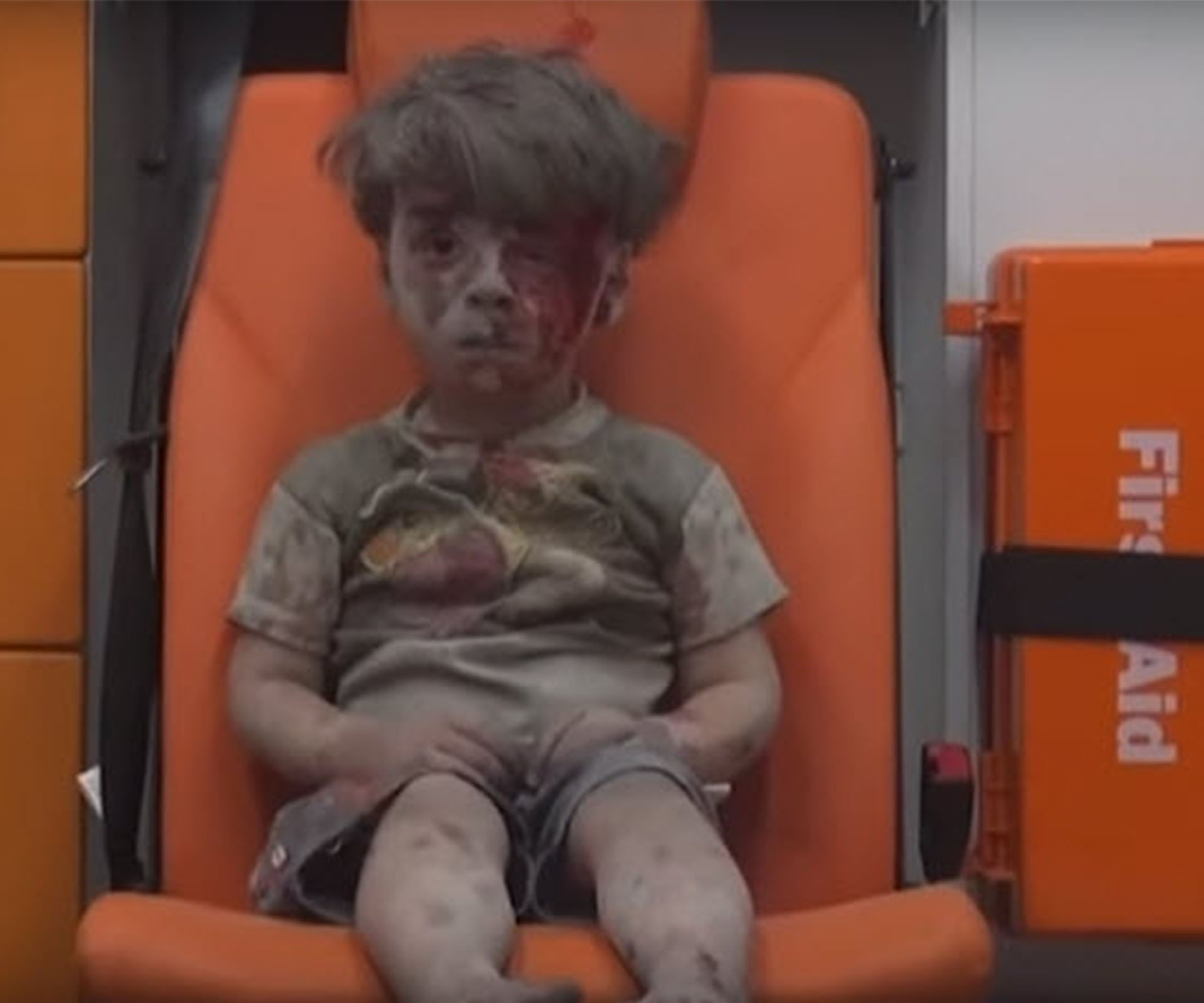 Syrian boy injured in airstrike